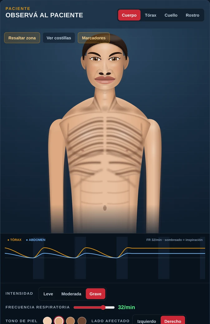 Captura del simulador de Semiología ventilatoria: tórax de un paciente con tiraje intercostal y gráfico del movimiento del tórax y el abdomen